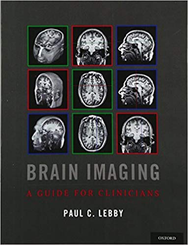 Brain Imaging: A Guide for Clinicians